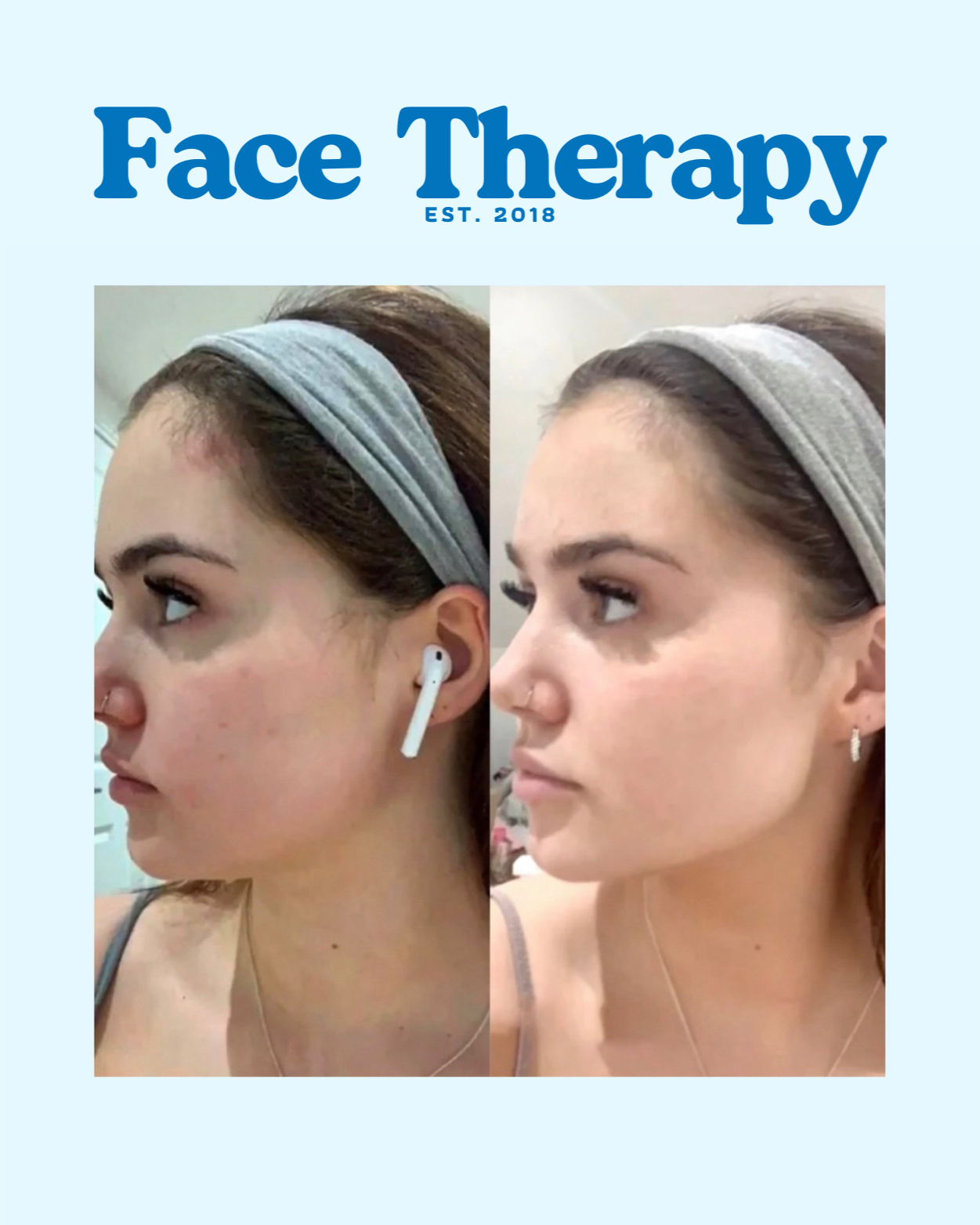 Face Lift Wand™