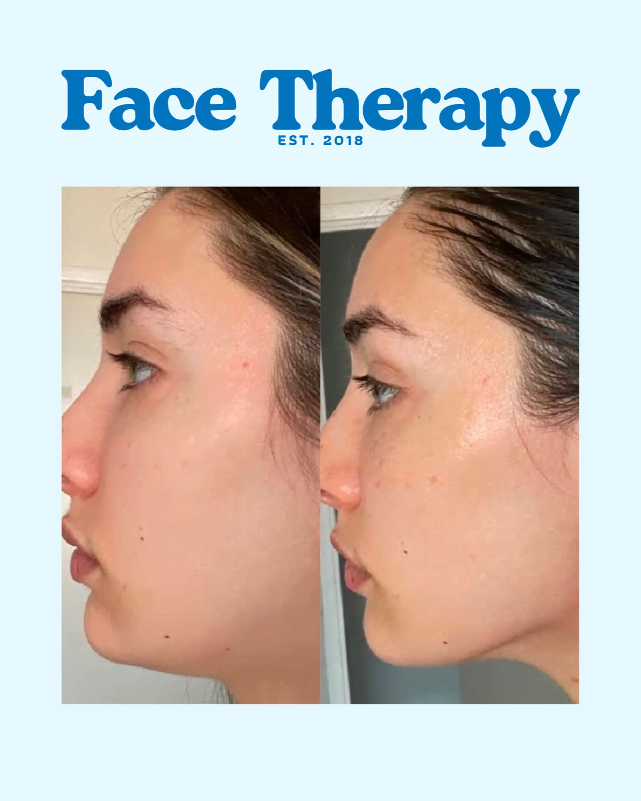 Face Lift Wand™